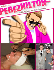 Perez Hilton on the Bird Poop Facial